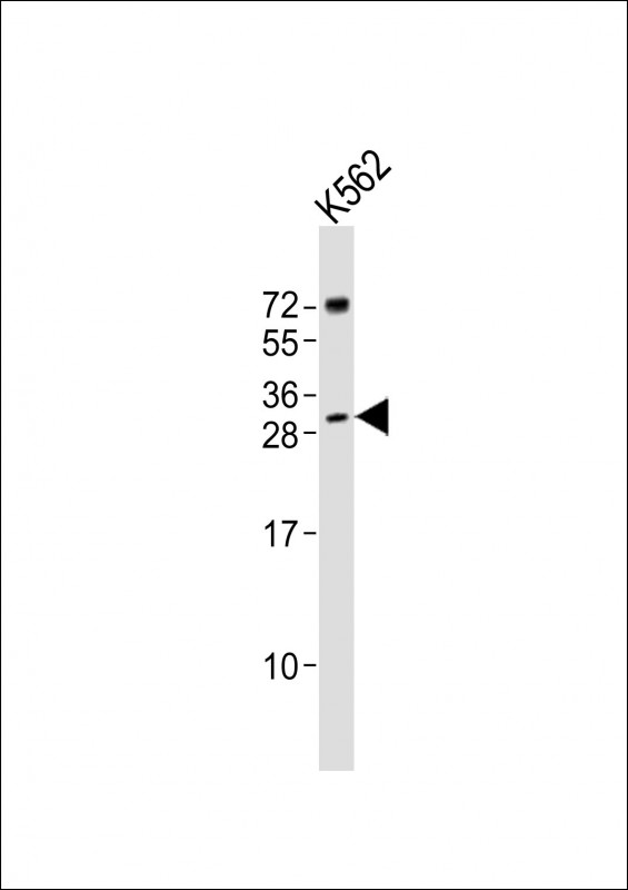 SRY Antibody - Anti-SRY Antibody (Center)at 1:1000 dilution + K562 whole cell lysates Lysates/proteins at 20 ug per lane. Secondary Goat Anti-Rabbit IgG, (H+L), Peroxidase conjugated at 1:10000 dilution. Predicted band size: 24 kDa. Blocking/Dilution buffer: 5% NFDM/TBST.