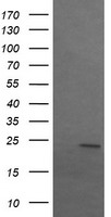 SRY Antibody - HEK293T cells were transfected with the pCMV6-ENTRY control (Left lane) or pCMV6-ENTRY SRY (Right lane) cDNA for 48 hrs and lysed. Equivalent amounts of cell lysates (5 ug per lane) were separated by SDS-PAGE and immunoblotted with anti-SRY.
