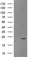 SRY Antibody - HEK293T cells were transfected with the pCMV6-ENTRY control (Left lane) or pCMV6-ENTRY SRY (Right lane) cDNA for 48 hrs and lysed. Equivalent amounts of cell lysates (5 ug per lane) were separated by SDS-PAGE and immunoblotted with anti-SRY.