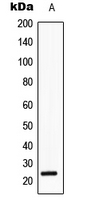SRY Antibody - Western blot analysis of SRY expression in HeLa (A) whole cell lysates.