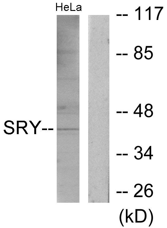 SRY Antibody - Western blot analysis of extracts from HeLa cells, using SRY antibody.