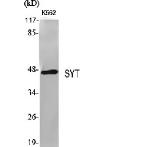 SS18 Antibody - Western blot of SYT antibody