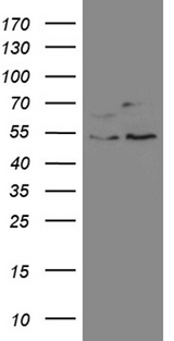 SS18 Antibody - HEK293T cells were transfected with the pCMV6-ENTRY control. (Left lane) or pCMV6-ENTRY. (Right lane) cDNA for 48 hrs and lysed. Equivalent amounts of cell lysates. (5 ug per lane) were separated by SDS-PAGE and immunoblotted with anti-SS18. (1:2000)