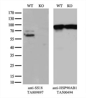 SS18 Antibody - Equivalent amounts of cell lysates  andHeLa cells  were separated by SDS-PAGE and immunoblotted with anti-SS18 monoclonal antibody. Then the blotted membrane was stripped and reprobed with anti-HSP90 antibody as a loading control.
