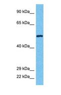 SS18 Antibody - Western blot of SSXT Antibody with human Fetal Kidney lysate.  This image was taken for the unconjugated form of this product. Other forms have not been tested.