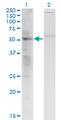 SS18 Antibody - Western Blot analysis of SS18 expression in transfected 293T cell line by SS18 monoclonal antibody (M07), clone 1C8.Lane 1: SS18 transfected lysate (Predicted MW: 45.9 KDa).Lane 2: Non-transfected lysate.