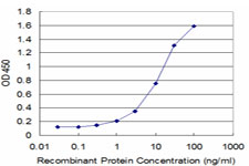 SS18 Antibody - Detection limit for recombinant GST tagged SS18 is approximately 0.3 ng/ml as a capture antibody.