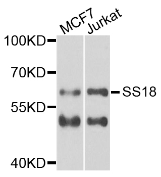 SS18 Antibody - Western blot analysis of extracts of various cells.