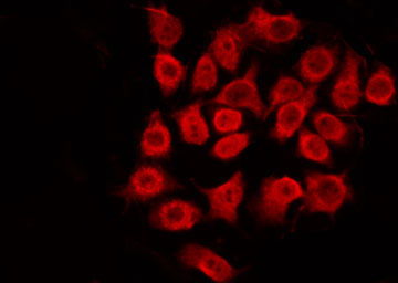 SS18 Antibody - Staining HepG2 cells by IF/ICC. The samples were fixed with PFA and permeabilized in 0.1% Triton X-100, then blocked in 10% serum for 45 min at 25°C. The primary antibody was diluted at 1:200 and incubated with the sample for 1 hour at 37°C. An Alexa Fluor 594 conjugated goat anti-rabbit IgG (H+L) Ab, diluted at 1/600, was used as the secondary antibody.