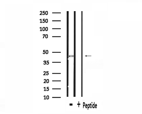 SS18 Antibody - Western blot analysis of extracts of 293 cells using SYT antibody.