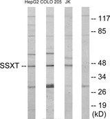 SS18 Antibody - Western blot analysis of extracts from HepG2 cells, COLO205 cells and Jurkat cells, using SSXT antibody.
