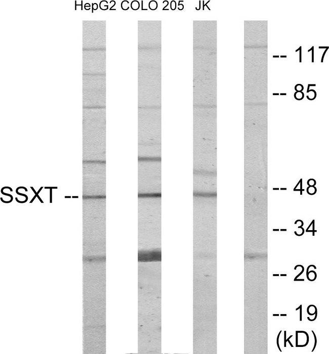 SS18 Antibody - Western blot analysis of extracts from HepG2 cells, COLO205 cells and Jurkat cells, using SSXT antibody.