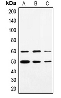 SS18 Antibody - Western blot analysis of SYT expression in HeLa (A); Jurkat (B); A431 (C) whole cell lysates.
