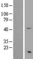 SS18 Protein - Western validation with an anti-DDK antibody * L: Control HEK293 lysate R: Over-expression lysate