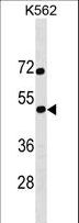 SS18L1 / CREST Antibody - SS18L1 Antibody western blot of K562 cell line lysates (35 ug/lane). The SS18L1 antibody detected the SS18L1 protein (arrow).
