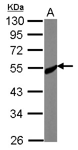SS18L1 / CREST Antibody - Sample (30 ug of whole cell lysate) A: MCF-7 10% SDS PAGE SS18L1 antibody diluted at 1:1000