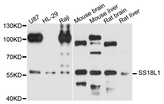 SS18L1 / CREST Antibody - Western blot analysis of extract of various cells.
