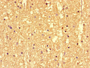 SS18L1 / CREST Antibody - Immunohistochemistry of paraffin-embedded human brain tissue at dilution of 1:100