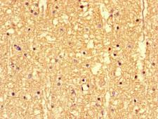 SS18L1 / CREST Antibody - Immunohistochemistry of paraffin-embedded human brain tissue at dilution of 1:100