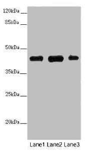 SS18L1 / CREST Antibody - Western blot All Lanes :SS18L1 antibody at 2 ug/ml Lane 1 : Mouse kidney tissue Lane 2 : Mouse lung tissue Lane 3 : Mouse spleen tissue Secondary Goat polyclonal to rabbit IgG at 1/10000 dilution Predicted band size: 43,41,34,30,44 kDa Observed band size: 43 kDa