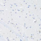SS18L1 / CREST Antibody - Immunohistochemistry of paraffin-embedded Mouse brain using SS18L1 Polyclonal Antibody at dilution of 1:100 (40x lens).