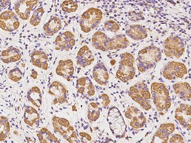 SS18L2 Antibody - Immunochemical staining of human SS18L2 in human stomach with rabbit polyclonal antibody at 1:100 dilution, formalin-fixed paraffin embedded sections.