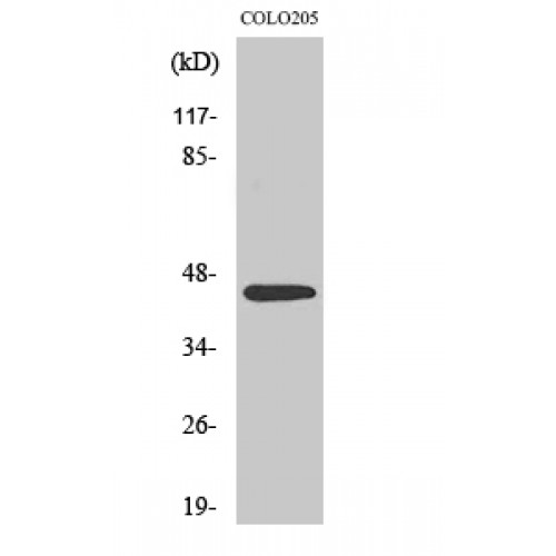SSB / La Antibody - Western blot of SSB antibody