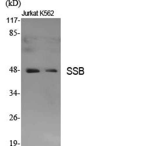SSB / La Antibody - Western blot of SSB antibody