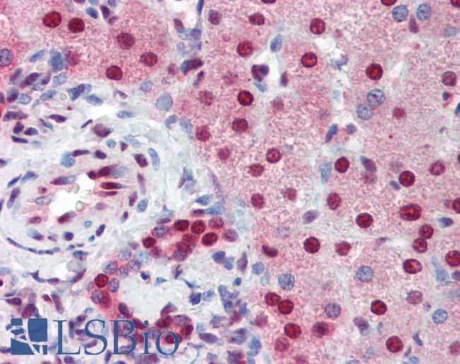 SSB / La Antibody - Anti-SSB antibody IHC of human liver. Immunohistochemistry of formalin-fixed, paraffin-embedded tissue after heat-induced antigen retrieval. Antibody concentration 5 ug/ml.  This image was taken for the unconjugated form of this product. Other forms have not been tested.