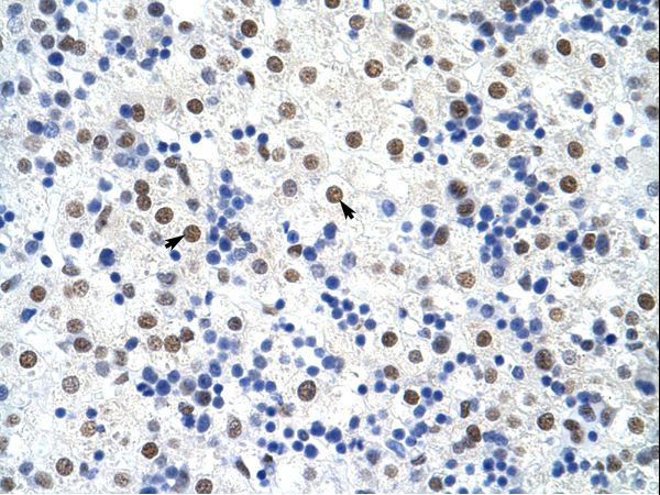 SSB / La Antibody - Human Liver.  This image was taken for the unconjugated form of this product. Other forms have not been tested.