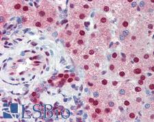 SSB / La Antibody - Anti-SSB antibody IHC of human liver. Immunohistochemistry of formalin-fixed, paraffin-embedded tissue after heat-induced antigen retrieval. Antibody concentration 5 ug/ml.  This image was taken for the unconjugated form of this product. Other forms have not been tested.