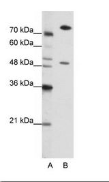 SSB / La Antibody - A: Marker, B: Jurkat Cell Lysate.  This image was taken for the unconjugated form of this product. Other forms have not been tested.