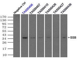 SSB / La Antibody - Immunoprecipitation(IP) of SSB by using monoclonal anti-SSB antibodies (Negative control: IP without adding anti-SSB antibody.). For each experiment, 500ul of DDK tagged SSB overexpression lysates (at 1:5 dilution with HEK293T lysate), 2 ug of anti-SSB antibody and 20ul (0.1 mg) of goat anti-mouse conjugated magnetic beads were mixed and incubated overnight. After extensive wash to remove any non-specific binding, the immuno-precipitated products were analyzed with rabbit anti-DDK polyclonal antibody.