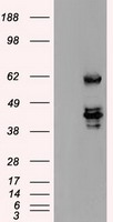 SSB / La Antibody - HEK293T cells were transfected with the pCMV6-ENTRY control (Left lane) or pCMV6-ENTRY SSB (Right lane) cDNA for 48 hrs and lysed. Equivalent amounts of cell lysates (5 ug per lane) were separated by SDS-PAGE and immunoblotted with anti-SSB.