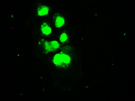 SSB / La Antibody - Anti-SSB mouse monoclonal antibody  immunofluorescent staining of COS7 cells transiently transfected by pCMV6-ENTRY SSB.