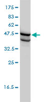 SSB / La Antibody - SSB monoclonal antibody (M01), clone 1D6-H5 Western blot of SSB expression in HL-60.