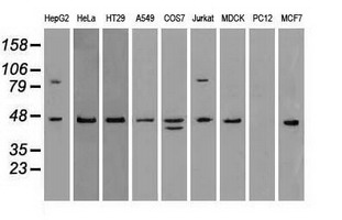 SSB / La Antibody - Western blot of extracts (35 ug) from 9 different cell lines by using anti-SSB monoclonal antibody.