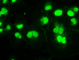 SSB / La Antibody - Anti-SSB mouse monoclonal antibody  immunofluorescent staining of COS7 cells transiently transfected by pCMV6-ENTRY SSB.