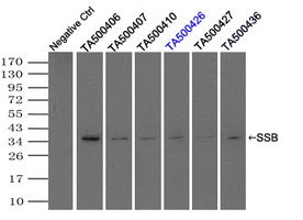 SSB / La Antibody - Immunoprecipitation(IP) of SSB by using monoclonal anti-SSB antibodies (Negative control: IP without adding anti-SSB antibody.). For each experiment, 500ul of DDK tagged SSB overexpression lysates (at 1:5 dilution with HEK293T lysate), 2 ug of anti-SSB antibody and 20ul (0.1 mg) of goat anti-mouse conjugated magnetic beads were mixed and incubated overnight. After extensive wash to remove any non-specific binding, the immuno-precipitated products were analyzed with rabbit anti-DDK polyclonal antibody.