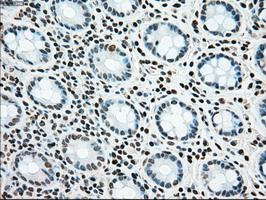 SSB / La Antibody - IHC of paraffin-embedded colon tissue using anti-SSB mouse monoclonal antibody. (Dilution 1:50).