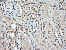 SSB / La Antibody - IHC of paraffin-embedded Kidney tissue using anti-SSB mouse monoclonal antibody. (Dilution 1:50).