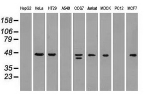 SSB / La Antibody - Western blot analysis of extracts (35ug) from 9 different cell lines by using anti-anti-SSBmonoclonal antibody.