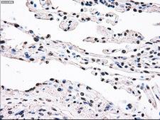 SSB / La Antibody - Immunohistochemical staining of paraffin-embedded lung tissue using anti-SSB mouse monoclonal antibody. (Dilution 1:50).