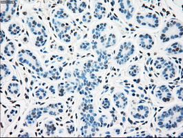SSB / La Antibody - IHC of paraffin-embedded breast tissue using anti-SSB mouse monoclonal antibody. (Dilution 1:50).