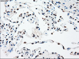 SSB / La Antibody - IHC of paraffin-embedded lung tissue using anti-SSB mouse monoclonal antibody. (Dilution 1:50).