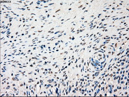 SSB / La Antibody - IHC of paraffin-embedded Ovary tissue using anti-SSB mouse monoclonal antibody. (Dilution 1:50).
