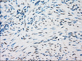 SSB / La Antibody - IHC of paraffin-embedded endometrium tissue using anti-SSB mouse monoclonal antibody. (Dilution 1:50).