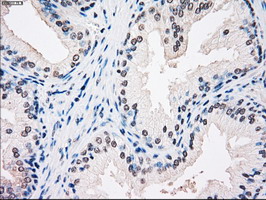 SSB / La Antibody - IHC of paraffin-embedded prostate tissue using anti-SSB mouse monoclonal antibody. (Dilution 1:50).