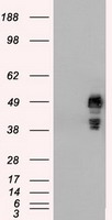 SSB / La Antibody - HEK293T cells were transfected with the pCMV6-ENTRY control (Left lane) or pCMV6-ENTRY SSB (Right lane) cDNA for 48 hrs and lysed. Equivalent amounts of cell lysates (5 ug per lane) were separated by SDS-PAGE and immunoblotted with anti-SSB.