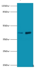 SSB / La Antibody - Western blot of Lupus La protein antibody at 2 ug/ml lane 1: mouse liver tissue lane 2: mouse brain tissue Secondary Goat polyclonal to Rabbit IgG at 1:10000 dilution. Predicted band size: 47.  This image was taken for the unconjugated form of this product. Other forms have not been tested.